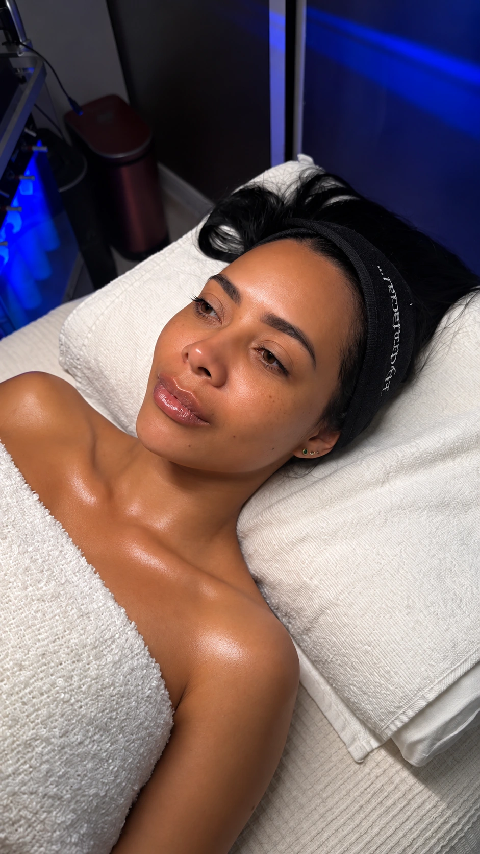 Angie: fotografía después aportada para el comparativo Hydrafacial