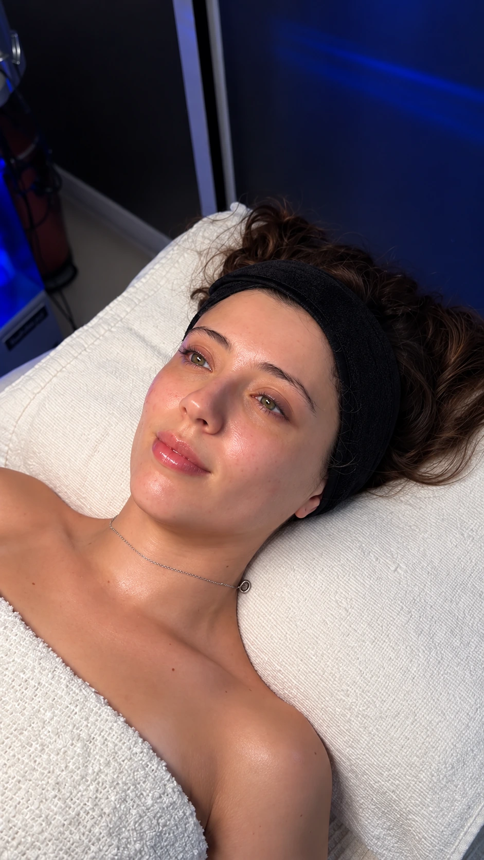Mariana: fotografía después aportada para el comparativo Hydrafacial